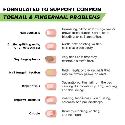 Nail Repair Pen™ – Extra Strength Nail Renewal Formula
